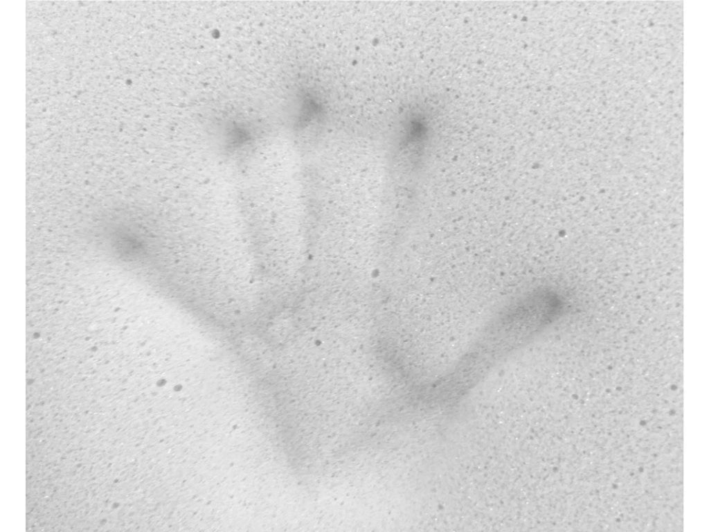 EMMA MEDICAL HARD 22